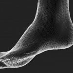 اسکن کف پا چیست؟ + کاربرد و انواع روش های اسکن کف پا