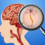 خوراکی های موثر در درمان بیماری های مغزی