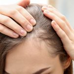 درمان های خانگی برای جلوگیری از ریزش مو +عکس