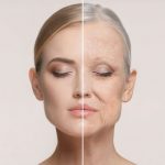 چین و چروک صورت؛ علائم، پیشگیری و درمان چین و چروک پوست